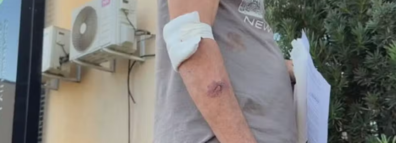 Pitbull protege idoso durante agressão e ajuda a impedir ataque do próprio filho