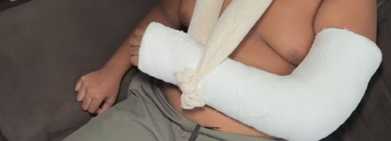 Adolescente com autismo tem braço quebrado após agressão dentro de escola estadual, denuncia mãe