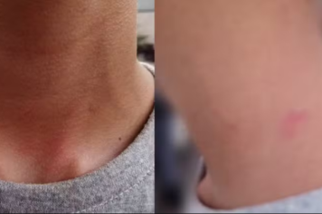 Região: Polícia investiga vereador suspeito de agredir criança após ela se recusar a descer de brinquedo em parque