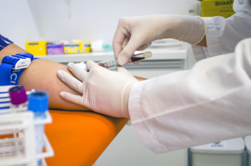 Para zerar a fila, Saúde fará 6.163 exames laboratoriais até o fim do mês