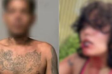 Homem é preso suspeito de arrancar parte do lábio da companheira com mordida
