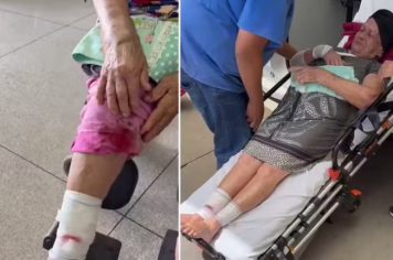 Idosa é atacada por cão que estava solto em rua de Riolândia