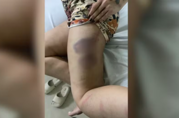 Jovem de 19 anos é agredida e mantida em cárcere privado pelo ex-namorado 
