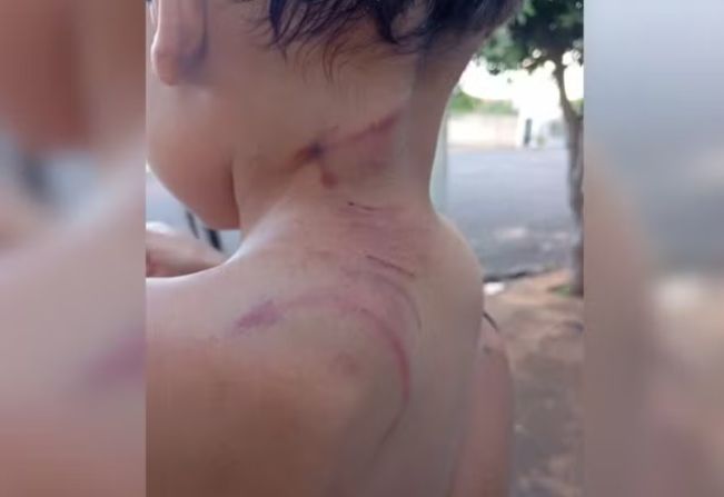 Mulher grávida e filho de 3 anos são atacados por cachorro enquanto caminhavam pela rua