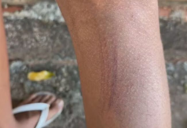 Adolescente denuncia agressão após ser acusado injustamente de furto em mercado