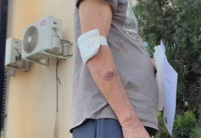 Pitbull protege idoso durante agressão e ajuda a impedir ataque do próprio filho