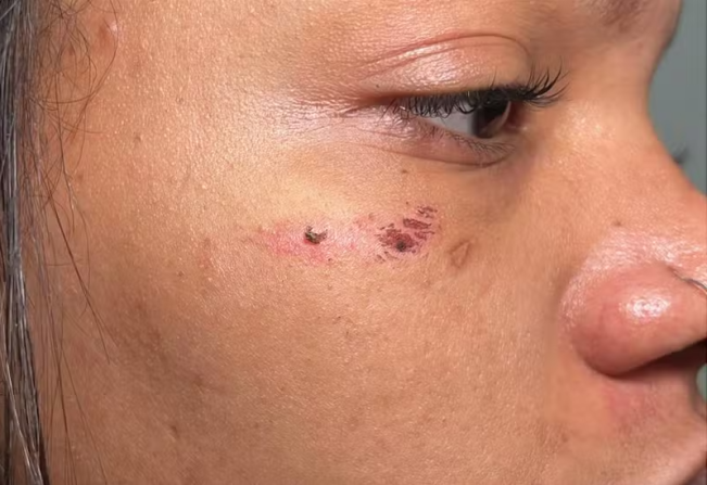 Mãe de grávida agredida por motorista em General Salgado diz estar revoltada: 'Covardemente'